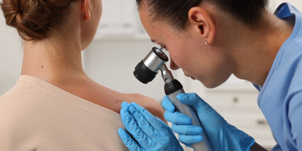 Cilt Kanseri Nedir? Belirtileri, Nedenleri ve Korunma Yolları
